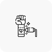 레이저 시술