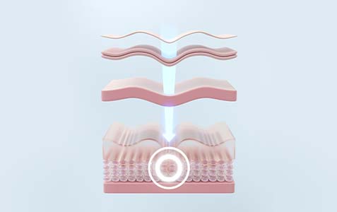 레이어드 타겟팅
