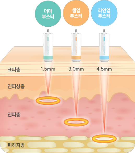 울트라 부스터 핸드피스